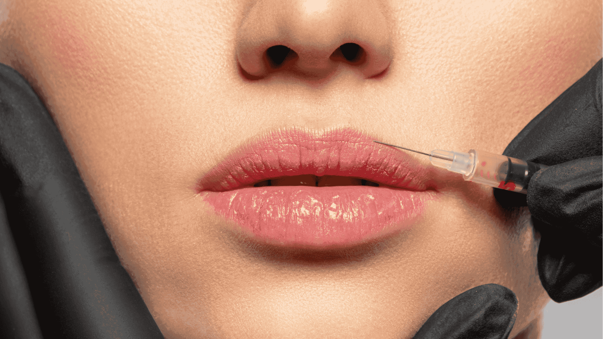 Dudak ve Dudak Çevresi