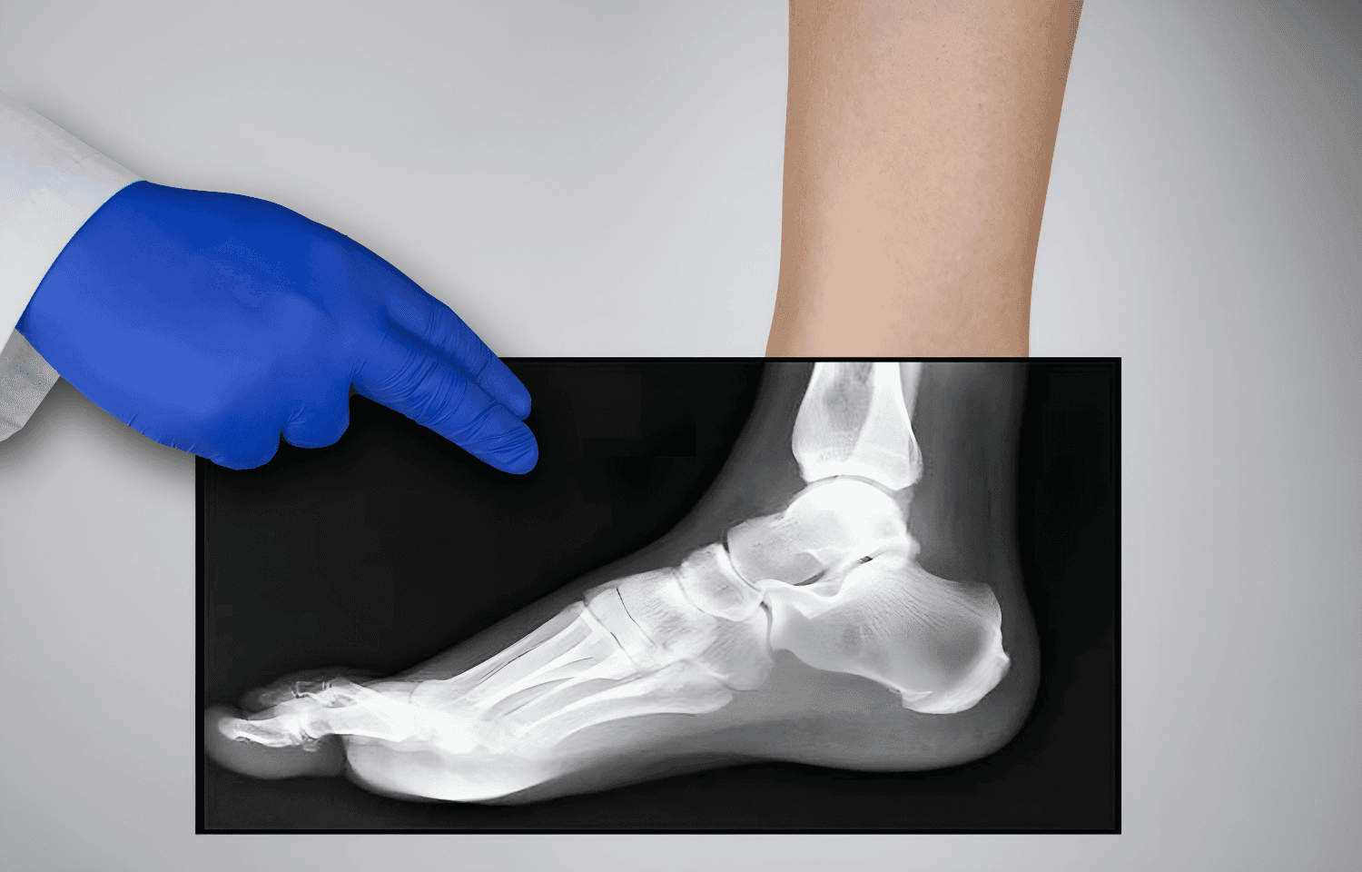 Ayak ve Ayak Bileği